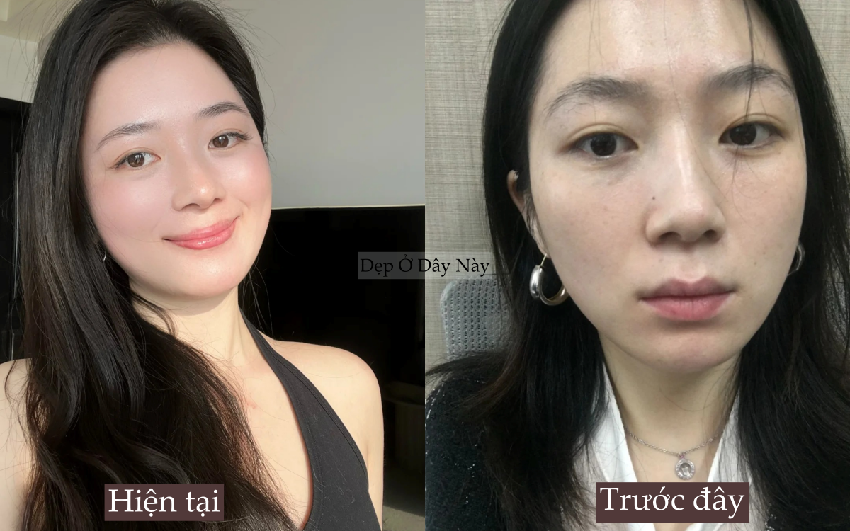 Ngo&agrave;i 30 da c&ograve;n đẹp hơn tuổi 20, n&agrave;ng blogger l&agrave;m đ&uacute;ng 5 điều n&agrave;y mỗi ng&agrave;y để 