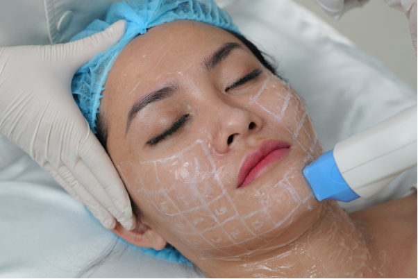 Top 7 c&ocirc;ng nghệ trẻ h&oacute;a da ti&ecirc;n tiến hiện nay - Ảnh 3.