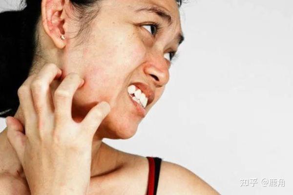 Người đàn ông 40 tuổi phát hiện ung thư gan giai đoạn cuối: Đáng tiếc ông đã bỏ qua dấu hiệu suốt 3 tháng - Ảnh 3.