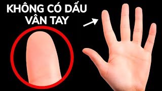 Chuyện tưởng đ&ugrave;a m&agrave; thật: Cứ đến m&ugrave;a đ&ocirc;ng l&agrave; trở th&agrave;nh 