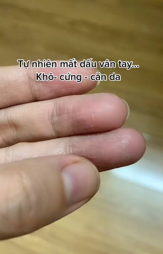 Chuyện tưởng đ&ugrave;a m&agrave; thật: Cứ đến m&ugrave;a đ&ocirc;ng l&agrave; trở th&agrave;nh 