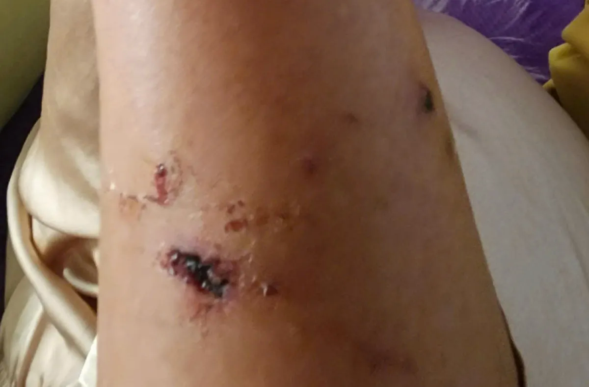 TP Hồ Ch&iacute; Minh: Khỉ rượt đuổi, tấn c&ocirc;ng người đi bộ tr&ecirc;n N&uacute;i Lớn Vũng T&agrave;u  - Ảnh 2.