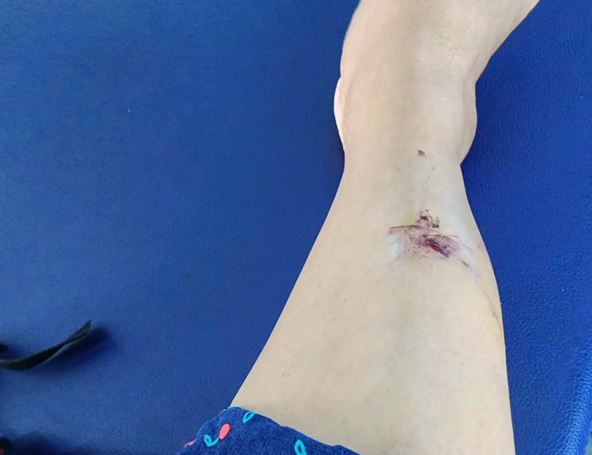 TP Hồ Ch&iacute; Minh: Khỉ rượt đuổi, tấn c&ocirc;ng người đi bộ tr&ecirc;n N&uacute;i Lớn Vũng T&agrave;u  - Ảnh 3.