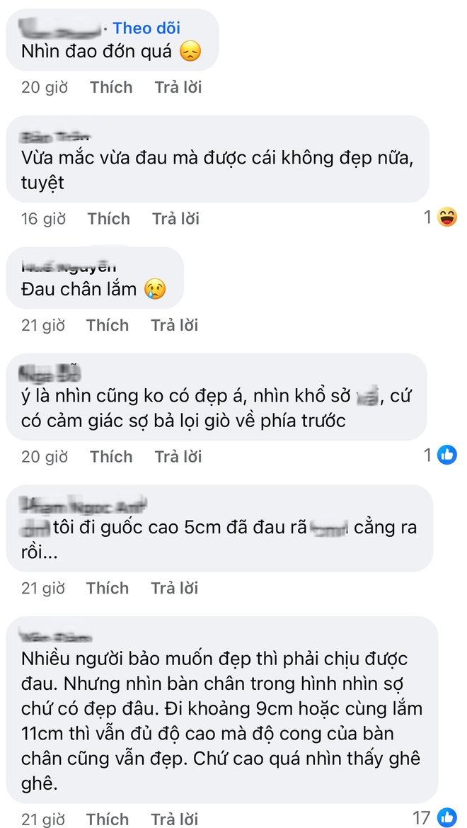 Barbie đời thực cũng khổ như b&uacute;p b&ecirc;: Nh&igrave;n b&agrave;n ch&acirc;n dị dạng v&igrave; gi&agrave;y cao g&oacute;t m&agrave; đau d&ugrave;m- Ảnh 6.