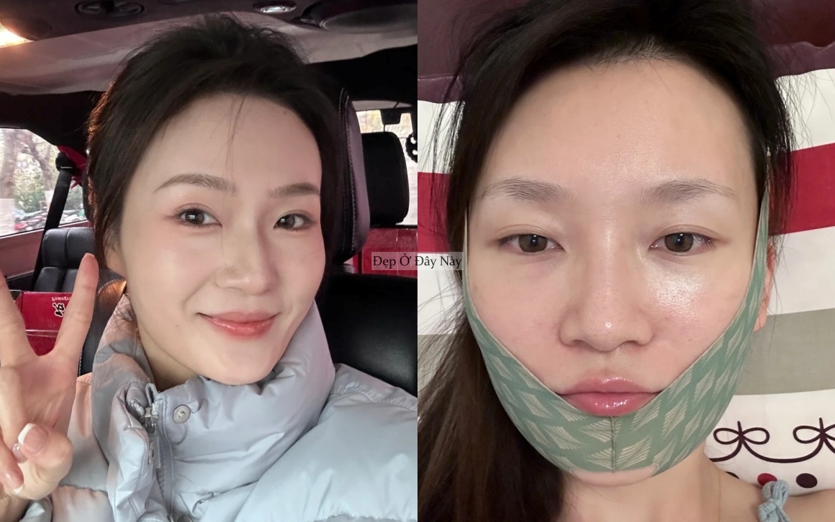 Trước Tết 7 ng&agrave;y, t&ocirc;i l&agrave;m đ&uacute;ng 5 việc n&agrave;y để mặt gọn lại v&agrave; da căng b&oacute;ng hơn hẳn - Ảnh 1.