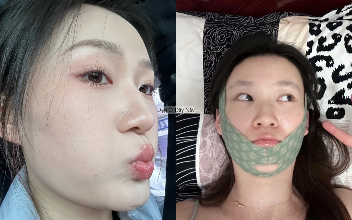 Trước Tết 7 ng&agrave;y, t&ocirc;i l&agrave;m đ&uacute;ng 5 việc n&agrave;y để mặt gọn lại v&agrave; da căng b&oacute;ng hơn hẳn - Ảnh 3.