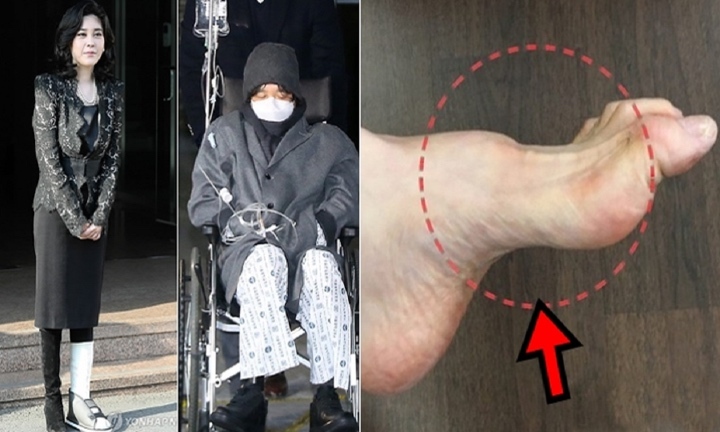 Lời nguyền di truyền của gia tộc Samsung v&agrave; căn bệnh Charcot-Marie-Tooth - Ảnh 3.