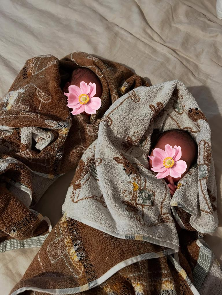 Nữ ca sĩ Jesy Nelson chia sẻ nỗi đau về con g&aacute;i mắc bệnh hiếm gặp - Ảnh 2.