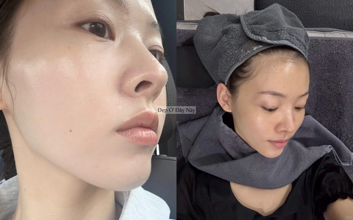 Dưỡng da kiểu H&agrave;n: B&iacute; quyết gi&uacute;p l&agrave;n da ng&agrave;y một khỏe đẹp từ b&ecirc;n trong của n&agrave;ng blogger U30 - Ảnh 7.