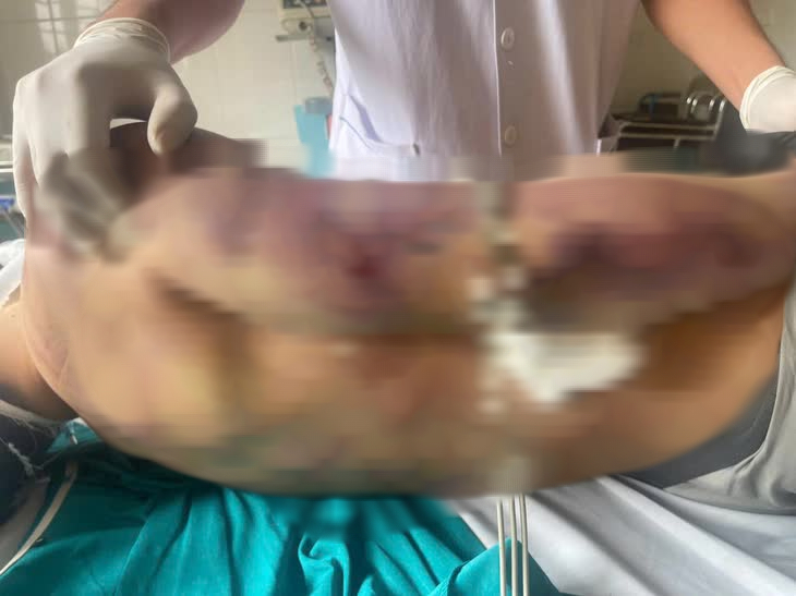 R&agrave; so&aacute;t cơ sở Bảo trợ x&atilde; hội sau vụ học vi&ecirc;n tử vong tại Hải H&agrave; - Ảnh 2.