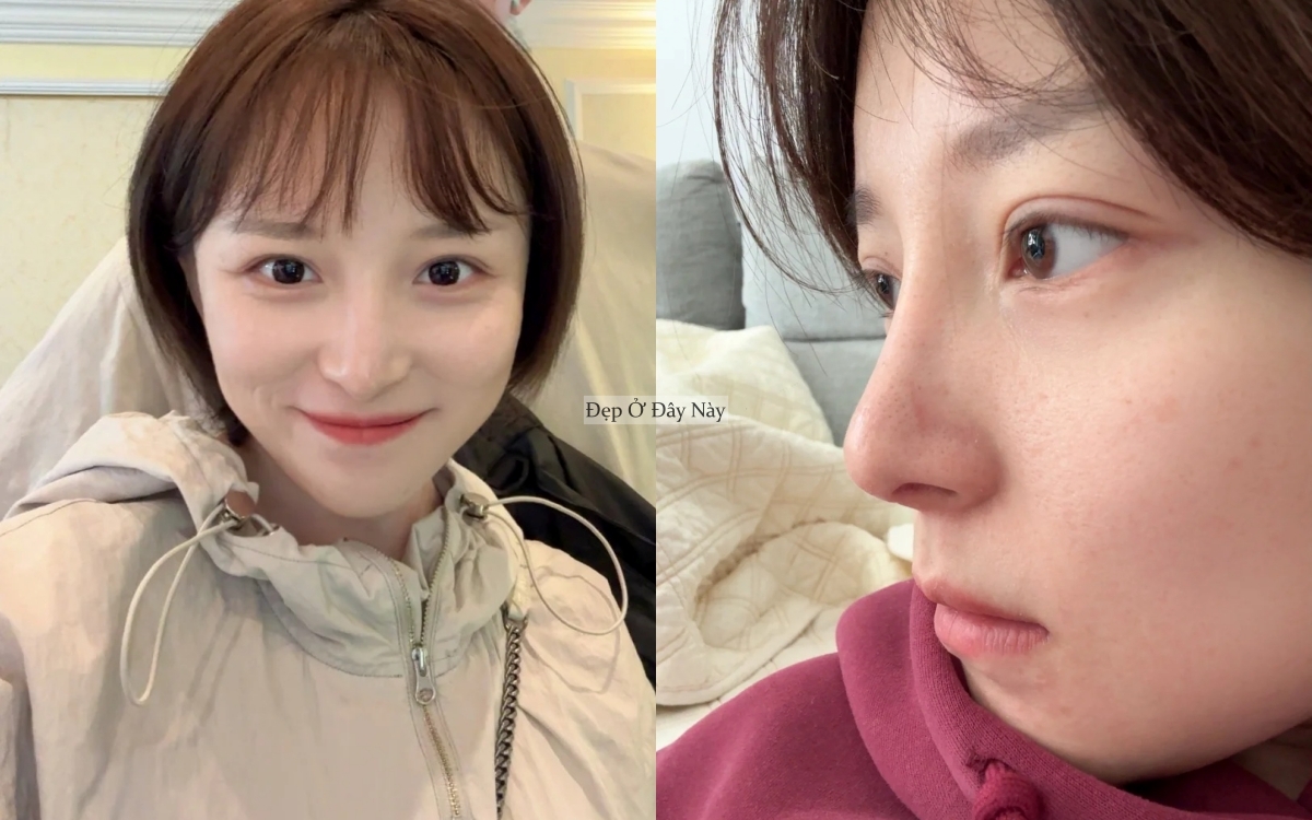 Công thức dưỡng da