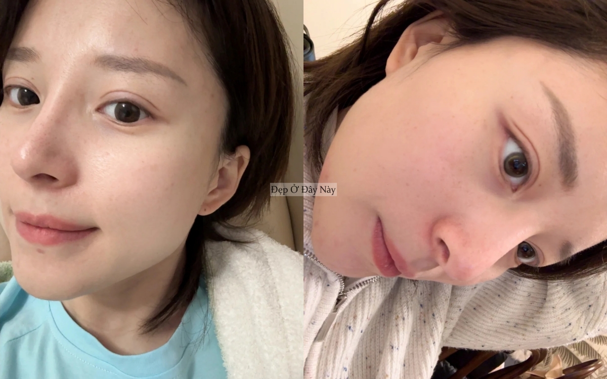 Công thức dưỡng da