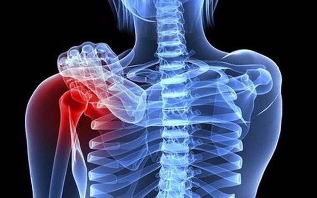 Cơn ho tưởng v&ocirc; hại của cậu b&eacute; 15 tuổi v&agrave; chẩn đo&aacute;n khiến cả gia đ&igrave;nh sụp đổ - Ảnh 3.