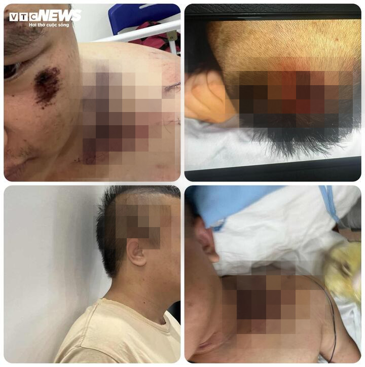 Trận đ&ograve;n 'nhập m&ocirc;n' tại Trung t&acirc;m C&ocirc;ng t&aacute;c x&atilde; hội Hải H&agrave;: Nỗi &aacute;m ảnh kh&ocirc;ng thể qu&ecirc;n - Ảnh 1.