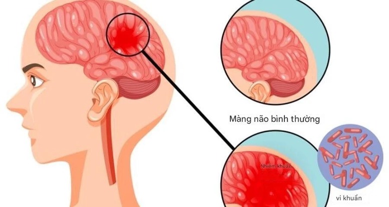  - Ảnh 1.