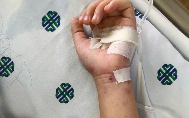 Bệnh não mô cầu có thể diễn tiến nhanh, cần đặc biệt chú ý 4 dấu hiệu này - Ảnh 2.