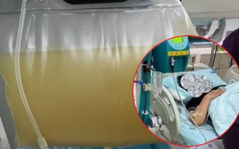 Ph&aacute;t hiện nguy&ecirc;n nh&acirc;n đau bụng của người phụ nữ 38 tuổi do th&oacute;i quen ăn uống - Ảnh 3.