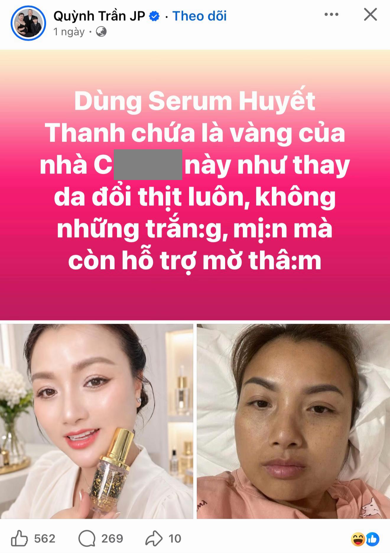 Quỳnh Trần JP g&acirc;y tranh c&atilde;i v&igrave; quảng c&aacute;o serum kh&ocirc;ng thực tế tr&ecirc;n mạng x&atilde; hội - Ảnh 2.