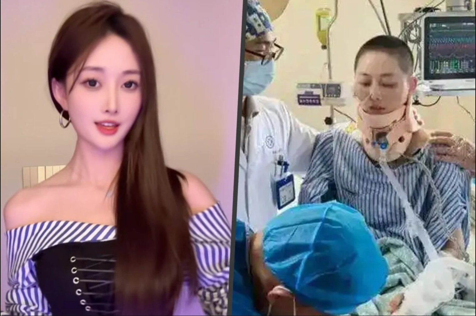 C&ocirc; g&aacute;i sống s&oacute;t sau c&uacute; ng&atilde; từ tầng 35 chung cư, sức khỏe hiện tại ra sao? - Ảnh 1.