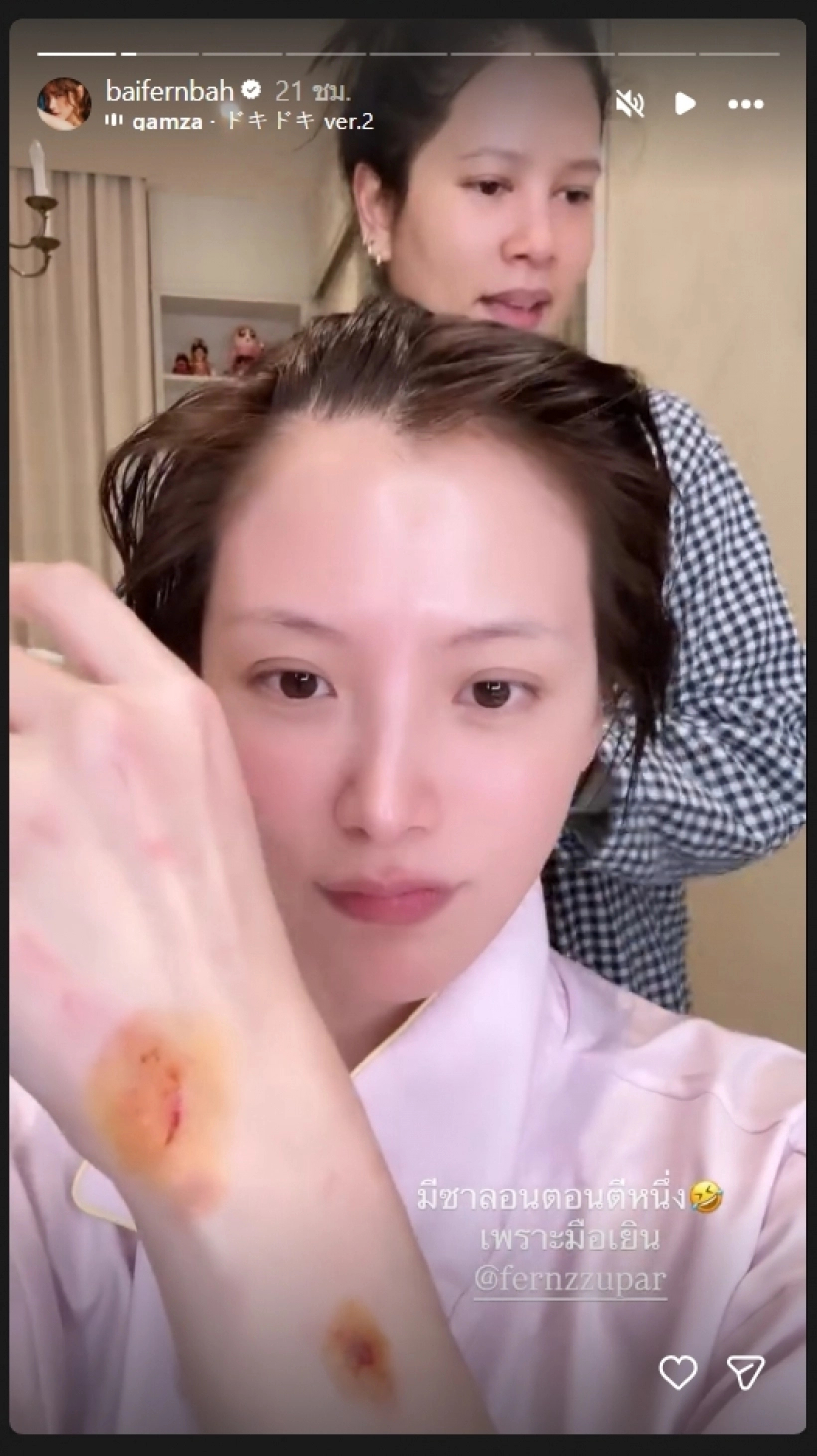  - Ảnh 1.