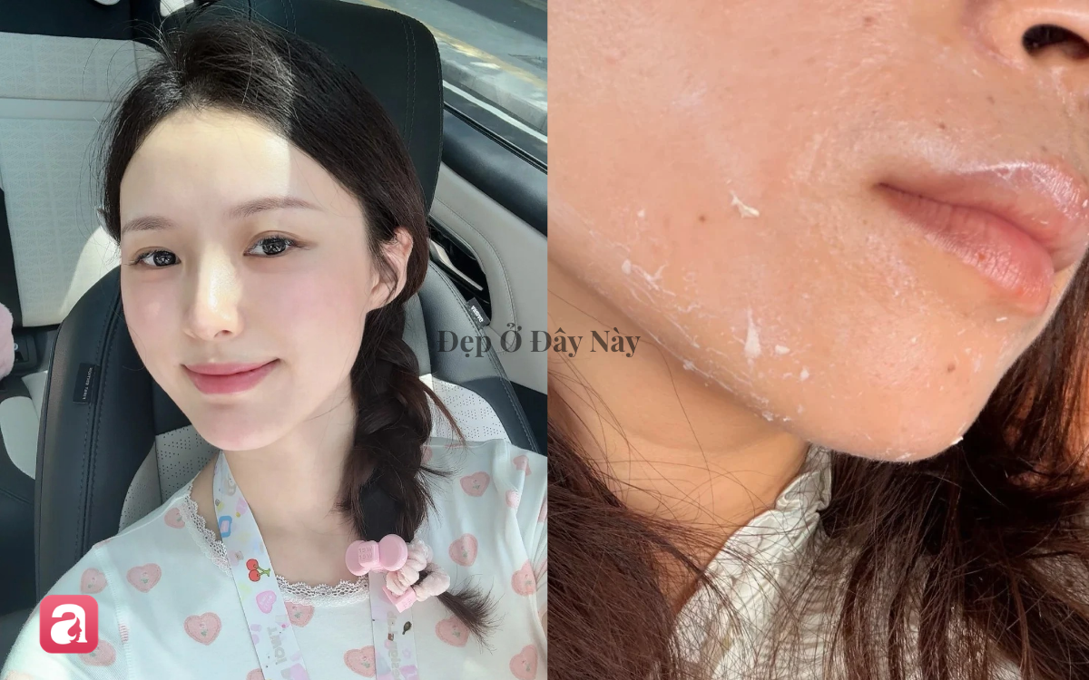 Vì sao thoa kem chống nắng hay bị vón cục, trắng bệch da vào mùa thu? - Ảnh 1.