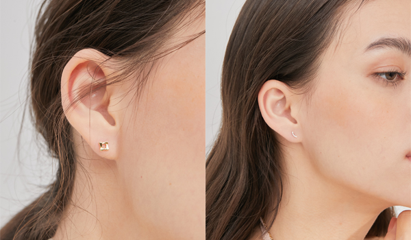 Tai mọc k&iacute;n đốm đen như &ldquo;trứng kiến&rdquo;, b&aacute;c sĩ cũng nổi da g&agrave;: Thủ phạm l&agrave; vật dụng quen thuộc nhiều người d&ugrave;ng chung mỗi ng&agrave;y - Ảnh 2.