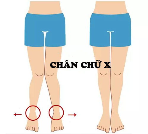 Kiểu d&aacute;ng ch&acirc;n 