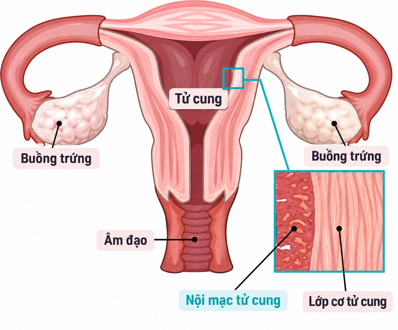 Dấu hiệu chảy m&aacute;u &acirc;m đạo sau m&atilde;n kinh: Cảnh b&aacute;o ung thư nội mạc tử cung - Ảnh 4.