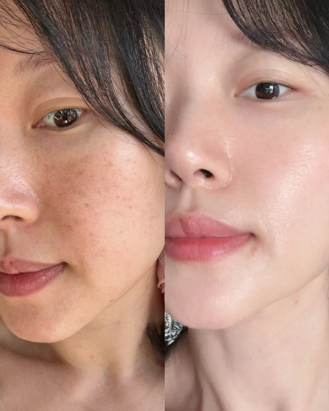 Da xỉn màu, kém đều màu ở tuổi 35+: Có thể chu trình chăm sóc của bạn đang thiếu bước này - Ảnh 1.