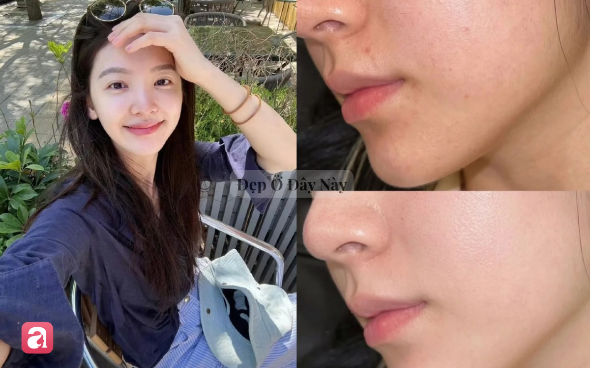 V&igrave; sao da l&atilde;o h&oacute;a v&agrave; mất collagen nhanh, lộ r&otilde; nếp nhăn v&agrave;o m&ugrave;a thu? - Ảnh 2.
