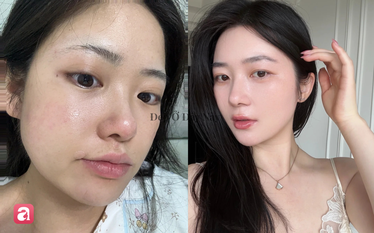 V&igrave; sao da l&atilde;o h&oacute;a v&agrave; mất collagen nhanh, lộ r&otilde; nếp nhăn v&agrave;o m&ugrave;a thu? - Ảnh 1.