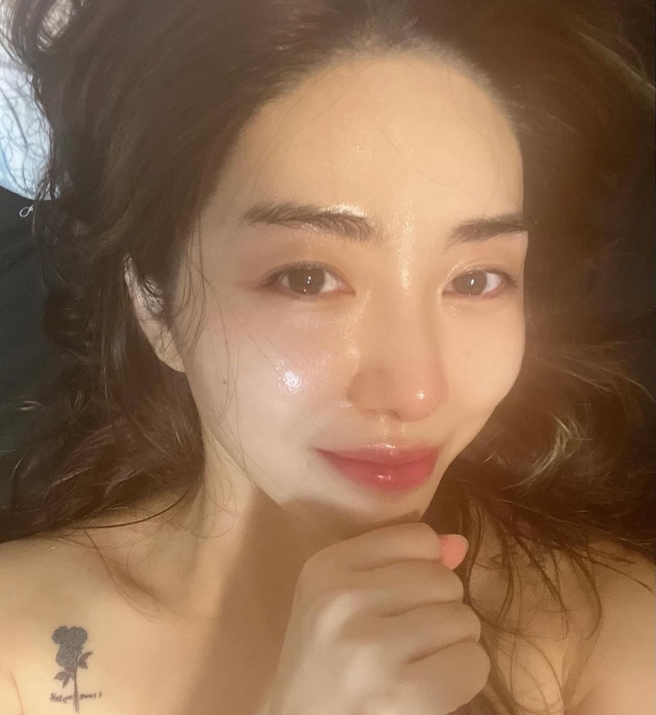 Nữ ca sĩ mất Tết, bị bỏng nặng một b&ecirc;n mặt khi đi l&agrave;m đẹp- Ảnh 1.