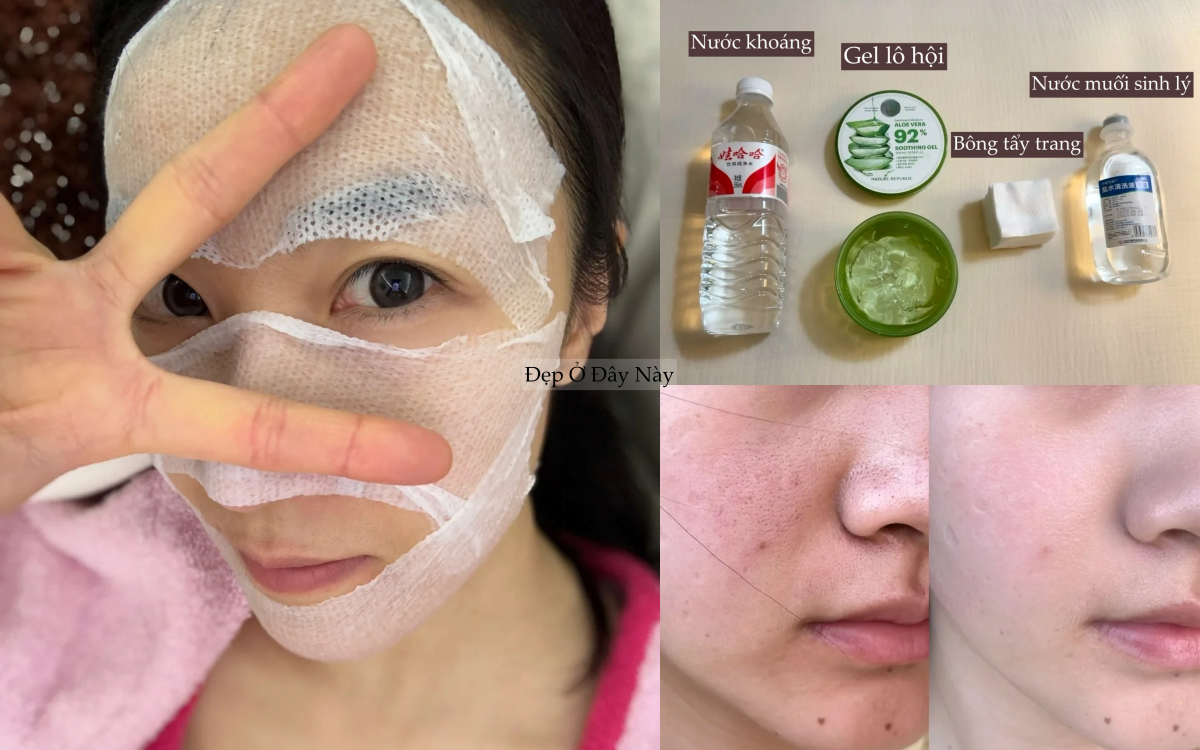 Kh&ocirc;ng d&ugrave;ng mỹ phẩm đắt tiền, blogger 25 tuổi vẫn thu nhỏ lỗ ch&acirc;n l&ocirc;ng thấy r&otilde; - Ảnh 1.