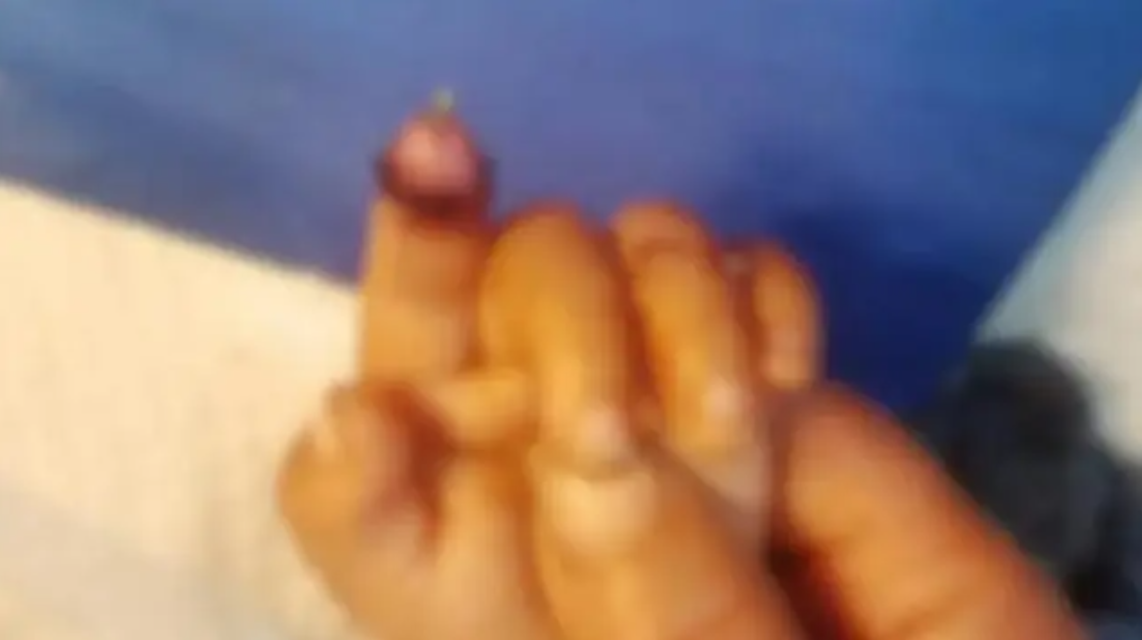 B&eacute; g&aacute;i 1 tuổi bị thỏ cắn đứt ng&oacute;n tay khi cho ăn- Ảnh 2.