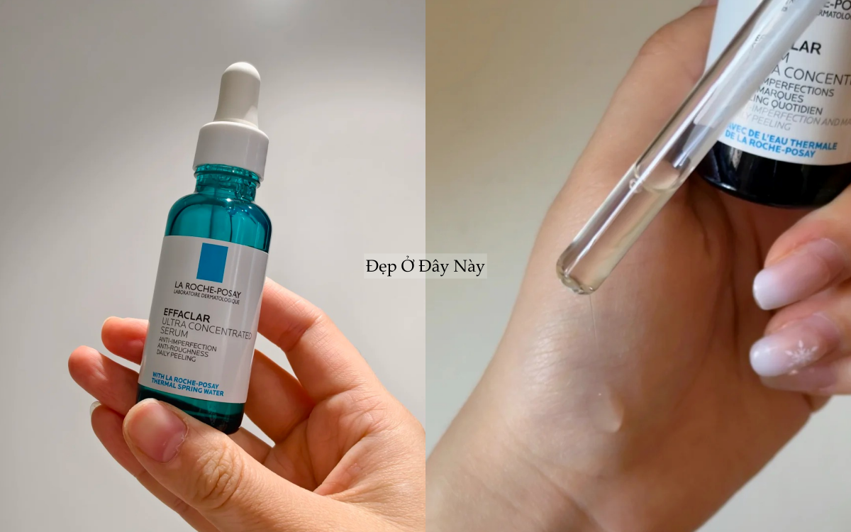 Lỗ ch&acirc;n l&ocirc;ng kh&ocirc;ng biến mất, nhưng t&ocirc;i đ&atilde; khiến ch&uacute;ng 