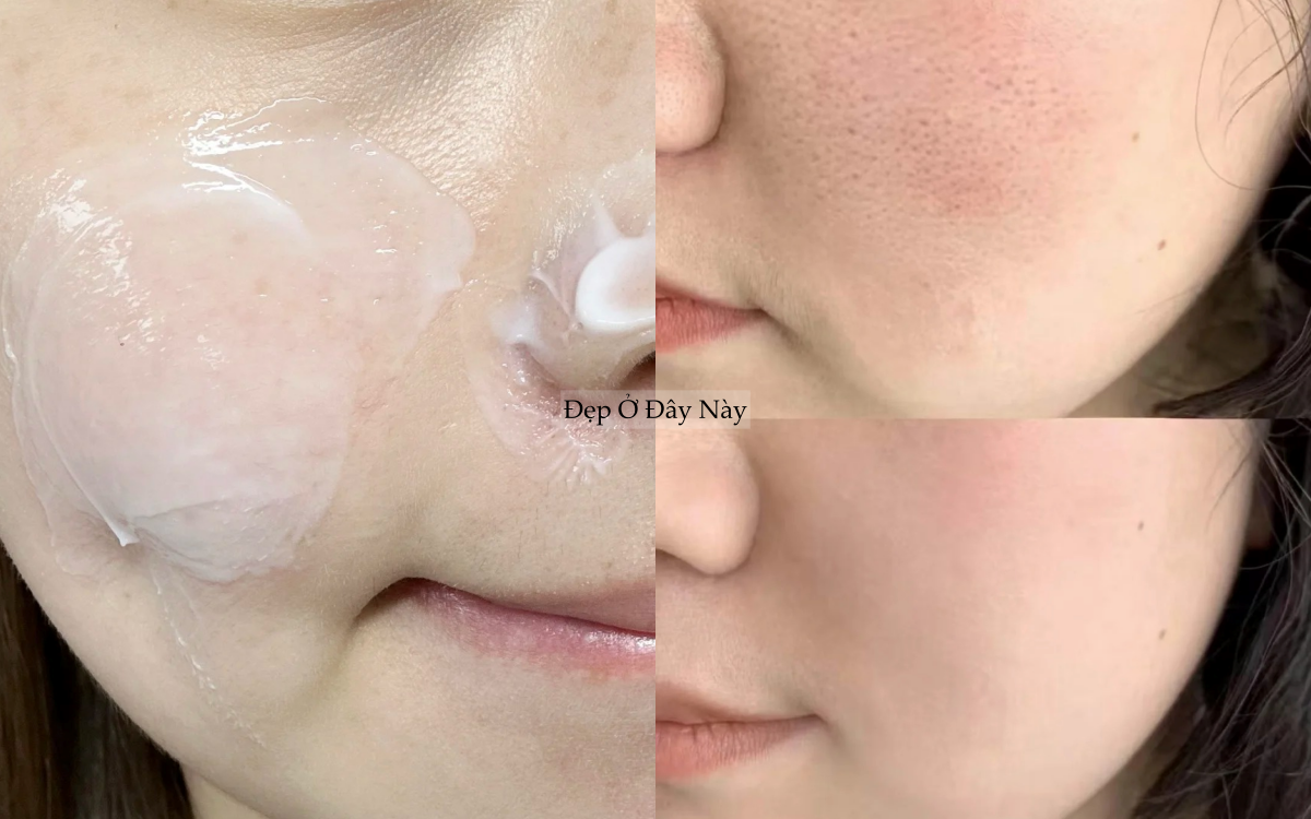 Lỗ ch&acirc;n l&ocirc;ng kh&ocirc;ng biến mất, nhưng t&ocirc;i đ&atilde; khiến ch&uacute;ng 