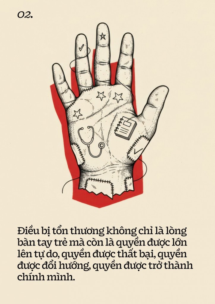 Những số mệnh bị phẫu thuật 