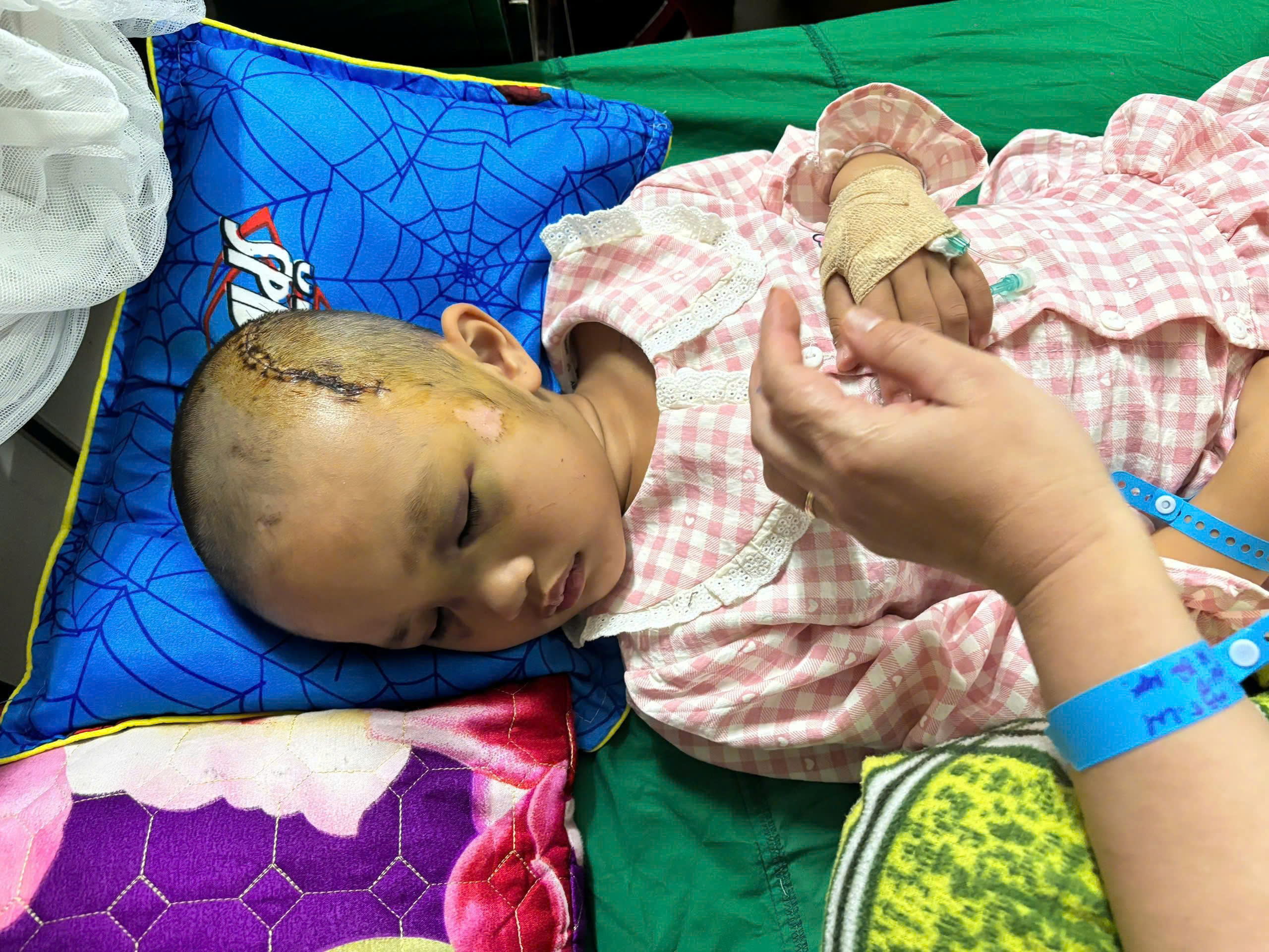 Ngã từ tầng 2 ngày mùng 2 Tết, bé gái 6 tuổi nguy kịch, gia đình nghèo kiệt quệ cầu cứu - Ảnh 3.