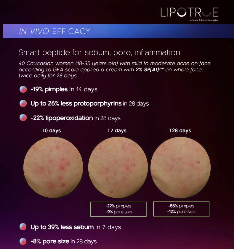 Inolab Derma ra mắt kem mụn không acid: Giải pháp hiệu quả cho làn da mụn nhạy cảm- Ảnh 3. Inolab Derma ra mắt kem mụn không acid: Giải pháp hiệu quả cho làn da mụn nhạy cảm- Ảnh 3.