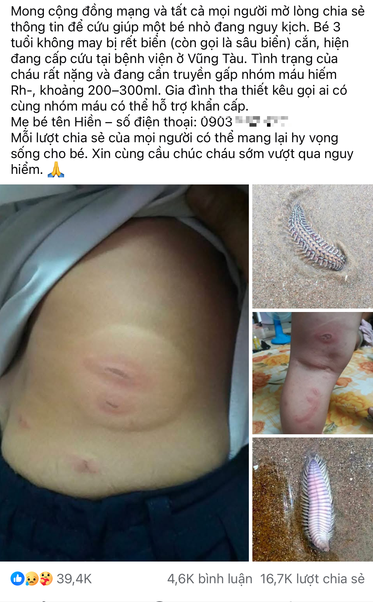Thực hư th&ocirc;ng tin b&eacute; 3 tuổi bị s&acirc;u biển cắn nguy kịch tại Vũng T&agrave;u - Ảnh 1.