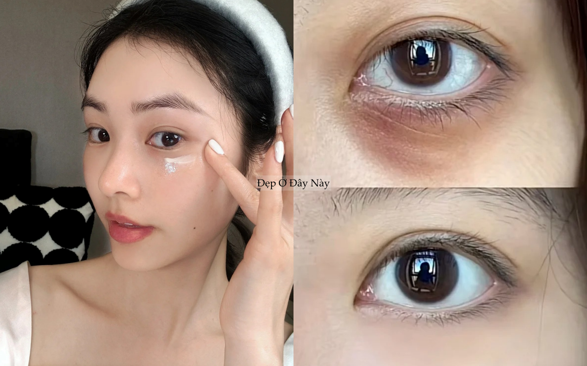 Ngo&agrave;i 30 tuổi mới hiểu: Kem mắt b&igrave;nh d&acirc;n d&ugrave;ng đ&uacute;ng c&ograve;n hiệu quả hơn đồ đắt tiền - Ảnh 1.