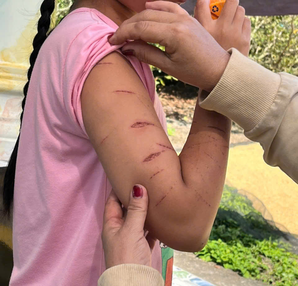 Nữ sinh lớp 5 ở C&agrave; Mau bị người th&acirc;n d&ugrave;ng dao cắt giấy g&acirc;y thương t&iacute;ch - Ảnh 1.