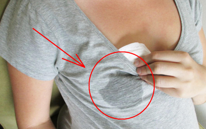 Mẹ v&ocirc; t&igrave;nh ph&aacute;t hiện dịch m&agrave;u v&agrave;ng tr&ecirc;n &aacute;o l&oacute;t b&eacute; g&aacute;i 13 tuổi, kết quả si&ecirc;u &acirc;m g&acirc;y sốc v&igrave;&hellip;- Ảnh 3.