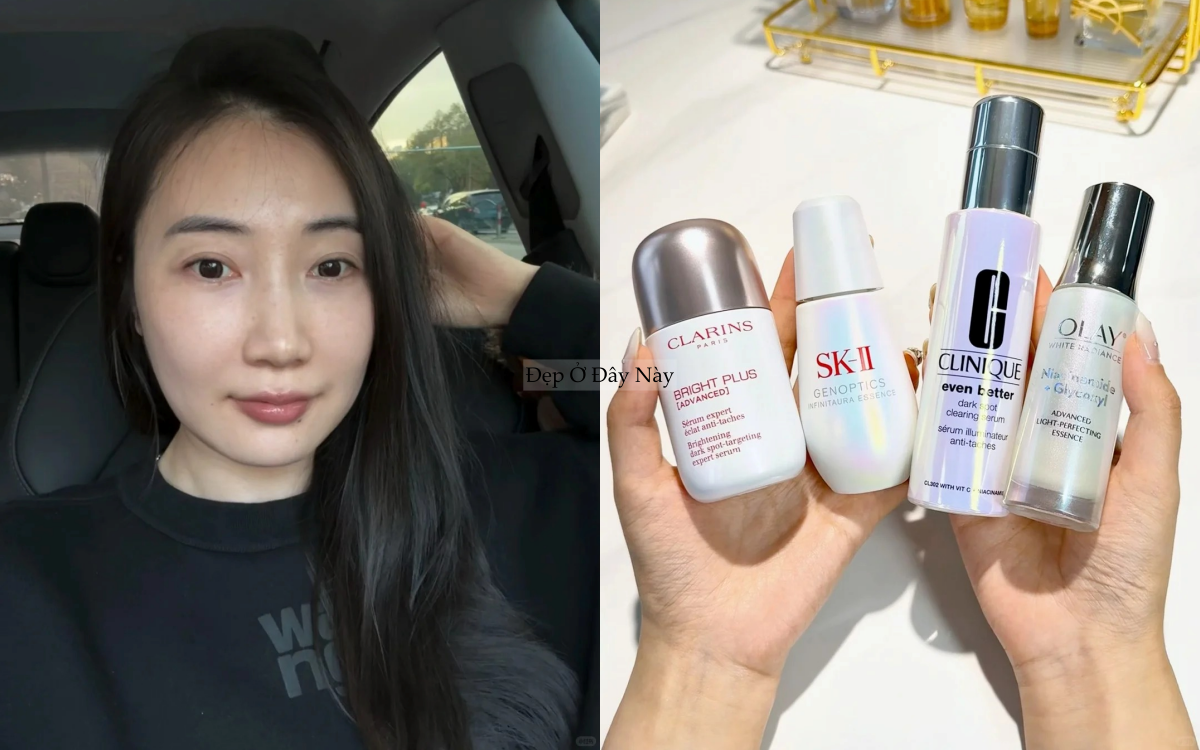 N&agrave;ng blogger h&eacute; lộ 4 serum dưỡng trắng khiến sạm n&aacute;m, vết th&acirc;m biến mất sau 1 năm ki&ecirc;n tr&igrave; - Ảnh 1.