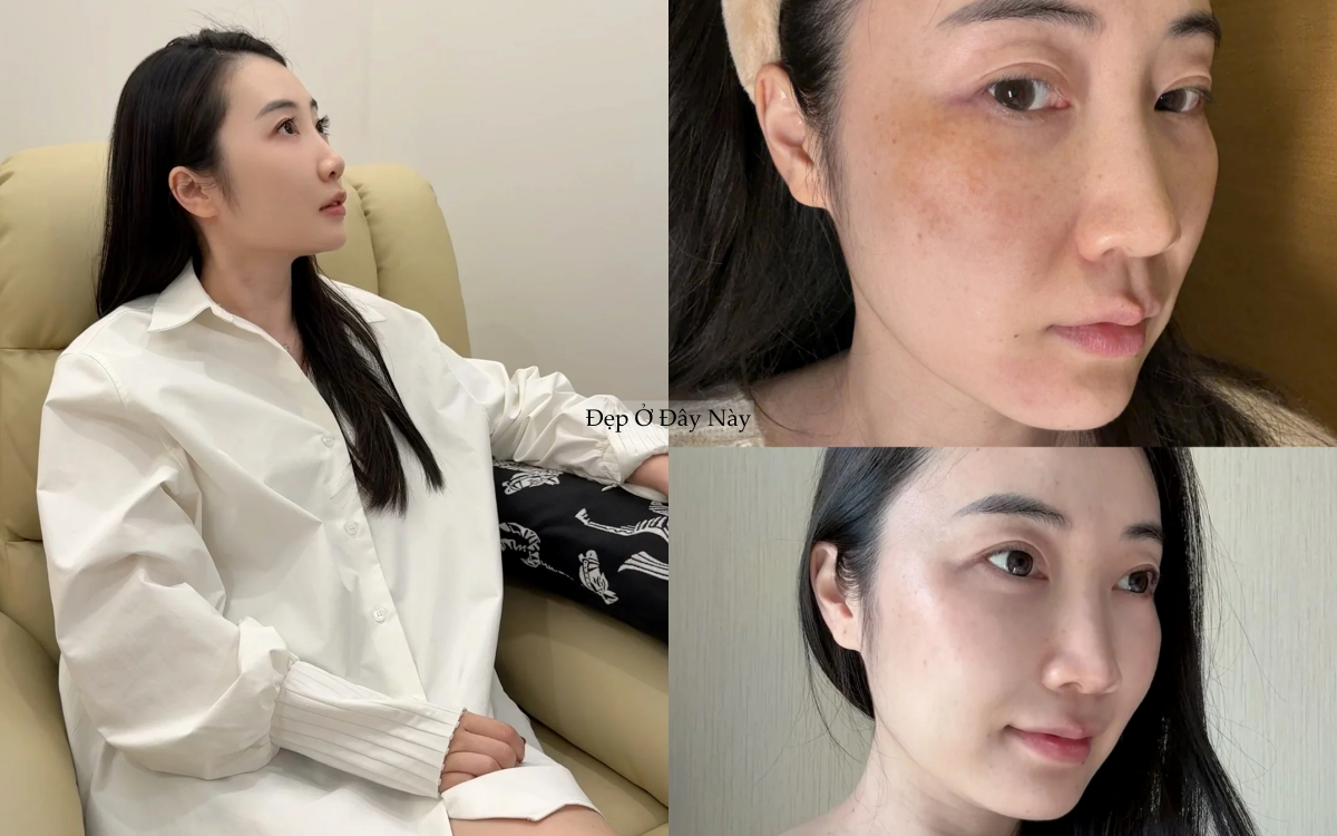 N&agrave;ng blogger h&eacute; lộ 4 serum dưỡng trắng khiến sạm n&aacute;m, vết th&acirc;m biến mất sau 1 năm ki&ecirc;n tr&igrave; - Ảnh 2.