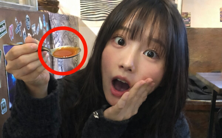 Suy thận ở tuổi 24 sau 5 năm sống 'lệch m&uacute;i giờ' - Ảnh 2.