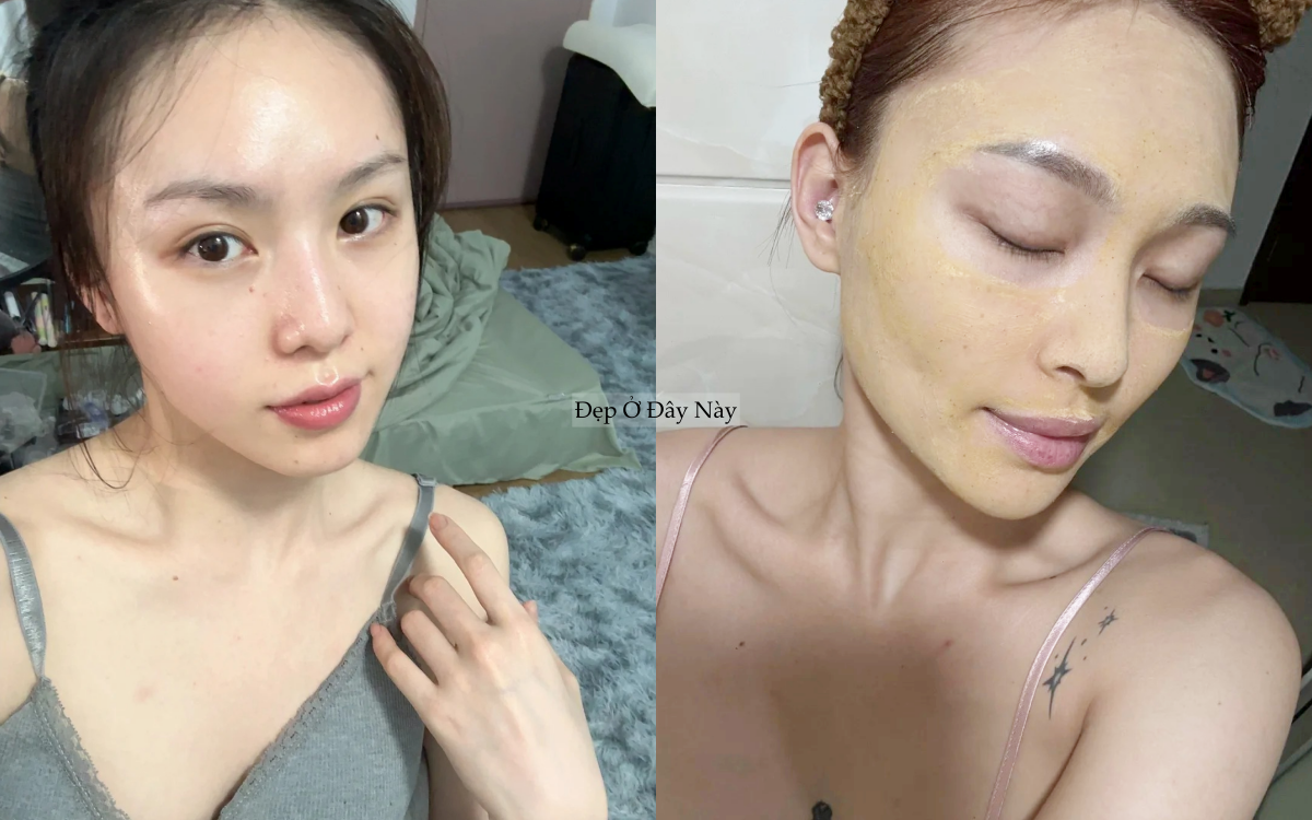 Da sạch mụn, mờ th&acirc;m nhờ 5 m&oacute;n dưỡng da từ nghệ chất lượng - Ảnh 1.