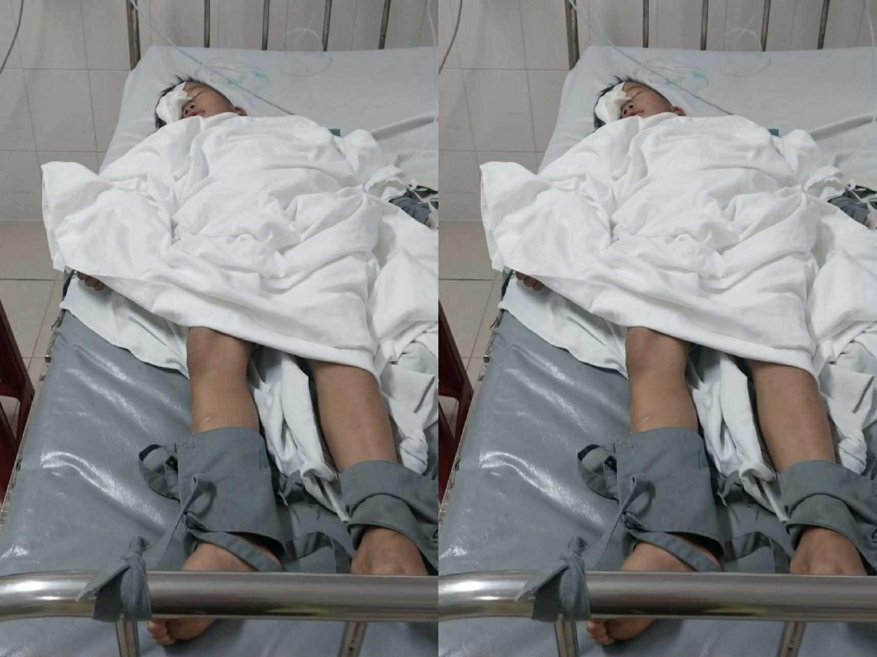 Phụ huynh tố c&aacute;o con lớp 1 bị bạn chọc mắt g&acirc;y thương t&iacute;ch nghi&ecirc;m trọng - Ảnh 1.