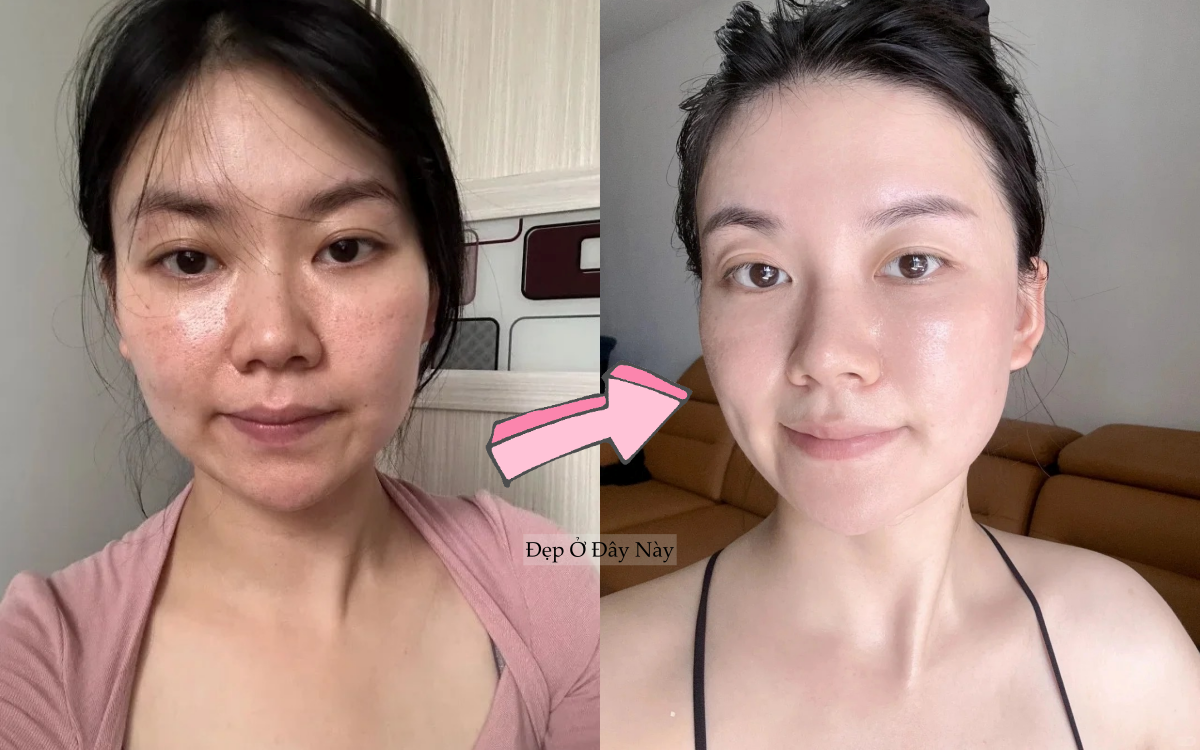 Kh&ocirc;ng cần mỹ phẩm đắt tiền, đ&acirc;y l&agrave; c&aacute;ch c&ocirc; n&agrave;ng ngo&agrave;i 30 tuổi giữ da trẻ l&acirc;u  - Ảnh 1.