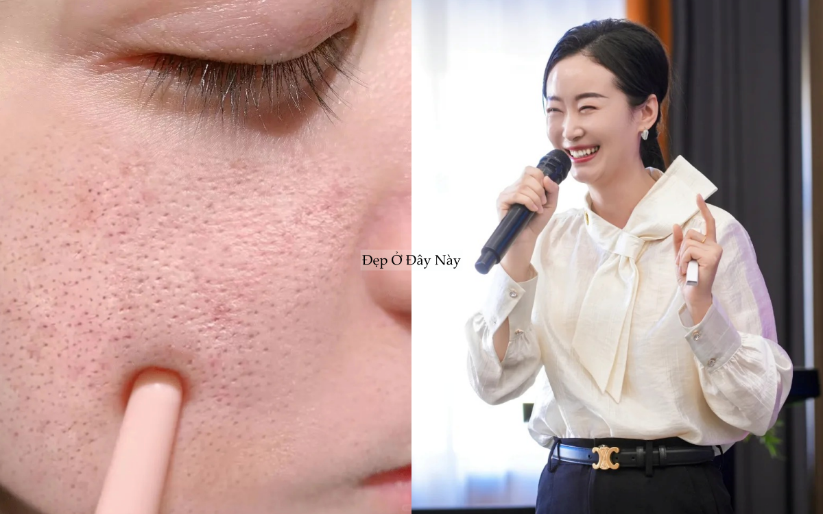 Chuyên gia chỉ ra: Có tới 4 loại lỗ chân lông to và cách khắc phục hiệu quả nhất - Ảnh 1.